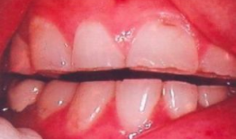 洗牙视频全过程,从准备到结束的全方位体验